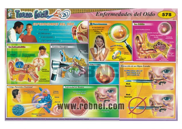 Enfermedades Del Oido